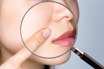 ほうれい線のアップ写真